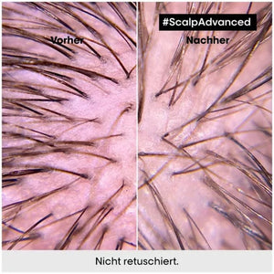 L'Oréal Professionnel Paris Série Expert Aminexil Advanced Anti-Hair Loss Activator Serum 90 ml